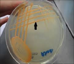 Image result for Rhodococcus equi
