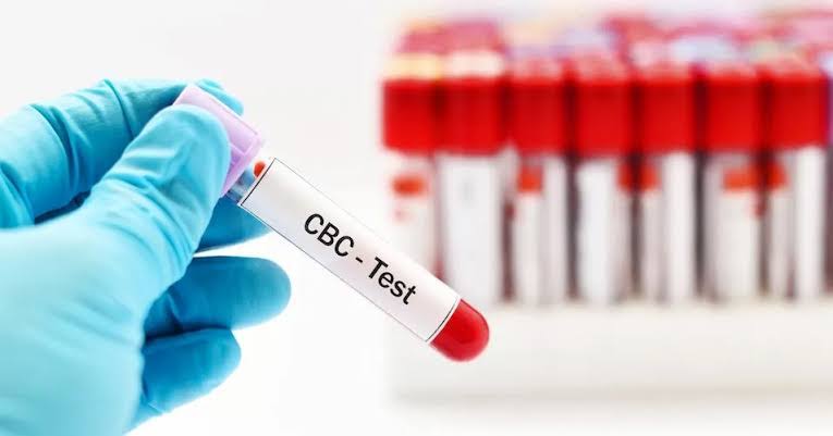 Complete blood count (CBC) product image