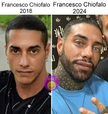 Francesco Chiofalo: " mi voglio sottoporre ad un intervento per allungare  le gambe. Io ho fatto il fotomodello per tanti anni e non sono mai riuscito  a fare passerella perché mi mancavano