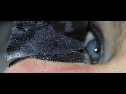 Biore Charcoal Pore Strips Before And After 5 Upclose Slow Mo Biore Charcoal Nose Strip Removal Largepores Nose Strips Biore Nose Strips Biore Charcoal