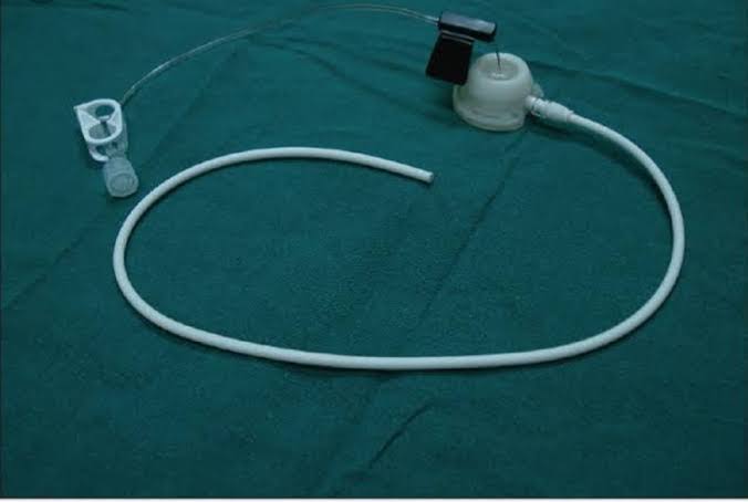 Chemoport insertion product image