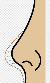 Plastic Surgery Nose Rhinoplasty Nose Surgery Mammal Face Cat Like Mammal Png Pngwing