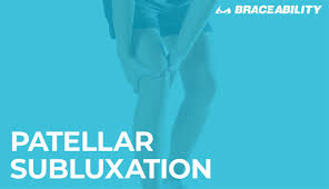 So how do you know if a knee injury involved a dislocated kneecap? Patellar Subluxation Subluxed Partially Dislocated Kneecap Facts