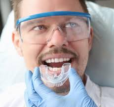 Night Guards Pasadena MD