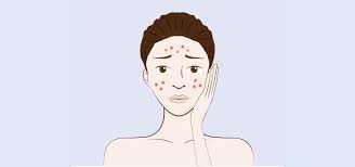 Maybe you would like to learn more about one of these? Supplements For Acne What Works And What Doesn T Patchmd