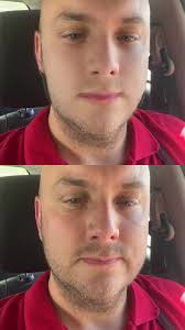 Might be heading to turkey to get hair plugs after seeing this! 🤣#tee...