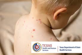 Image result for measles