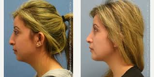 Douglas Hendricks, MD, Board Certified Plastic Surgeon