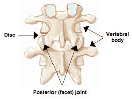 Joint mobilisation techniques can be used to unlock the facet joints, . Facet Disease Facet Syndrome Neck Pain Or Back Pain