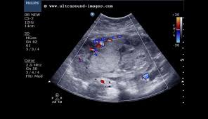 We did not find results for: A Gallery Of High Resolution Ultrasound Color Doppler 3d Images Amniotic Fluid