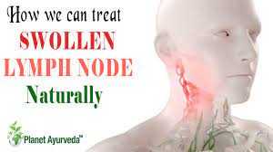 How We Can Treat Swollen Lymph Node Naturally? - Planet Ayurveda
