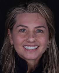 Implantar Sorrisos Odontologia