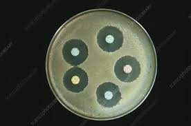 The addition of starch to mueller hinton agar ensures that toxic factors found during growth will be absorbed, and its presence is often essential to establish growth from very. Mueller Hinton Agar Keyword Search Science Photo Library