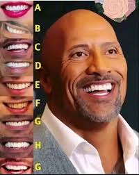 Which set of teeth (A-G) do you think matches The Rock's famous bright  white grin?