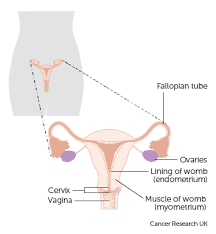 This gynaecological cancer awareness month, lets ensure all young women are aware of the symptoms. Fallopian Tube Cancer Ovarian Cancer Cancer Research Uk
