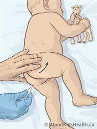 The drug you're taking would break down too quickly in your digestive tract if you took it as a pill or liquid. Suppository Instructions