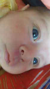 Mi Bebe Tiene Sus Ojos Amarillos Mamas Marzo 2016 Ninos Creciendo Felices Babycenter