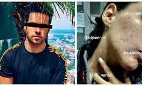 Eleazar gómez ha dado muestra de su talento como cantante, pero sin duda el mundo de la actuación es lo que esta semana surgieron los rumores del rompimiento entre danna paola y eleazar gómez. Tras Agredir A Su Pareja Eleazar Gomez Podria Pisar La Carcel Esta Misma Noche Futbol Rf