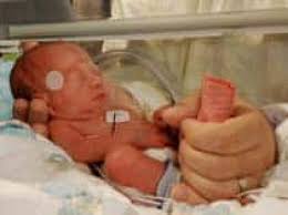 Calgary woman delivers identical quadruplets in U.S.