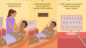 Does tamil have maximum number of words for 'woman'? Electrocardiogram Ecg Uses Side Effects Procedure Results