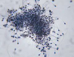 Wie Lange Uberleben Spermien An Der Luft