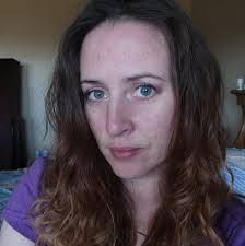 This is the Kristeller Maneuver 📸 and Words Reposted from @evarosebirth  WHO: Application of manual fundal pressure ( Kristeller maneuver ) to  facilitate childbirth during the second stage of labour is not