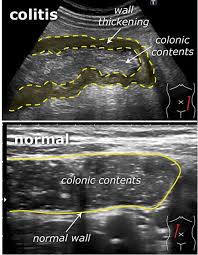 Pin On Radiology