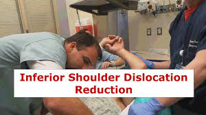 Image result for Shoulder Relocation Maneuvers