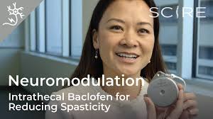 Epidural Stimulation