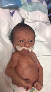 Jonathan "Jonny" Mallard, class of 1975. Sharing a post from his sister  Jamie Mallard Stamper. Jonny's parents, Jim and MaryAnn, both taught at  North Hardin/JTA for many years.  https://www.facebook.com/share/p/kK3oS8QwZw3Ef6uV/?mibextid=JOZb8W