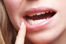 How to stop bleeding after tooth extraction. 6 Common Complications After Wisdom Tooth Surgery