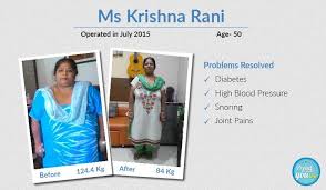 Pin On Before After