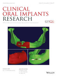 Ling_lingx streams live on twitch! Clinical Oral Implants Research Vol 28 No 5