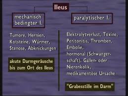 Darmverschluss (ileus) ein darmverschluss oder ileus ist eine lebensgefährliche akute darmerkrankung. Ursachen Und Symptome Des Paralytischen Und Mechanischen Darmverschlusses Ileus