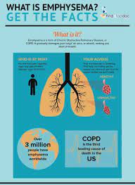 What Is Emphysema? Causes, Symptoms, Home Remedies