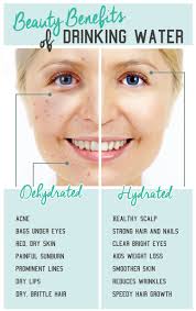 It also helps prevent split ends and brittle hair, as well as makes your scalp healthy. Bella Oasis Day Spa On Twitter Drinking Water Is Healthy And Important For Your Body To Maintain Its Functions And Your Skin Thrives On Having Enough Water To Be Hydrated And Improve