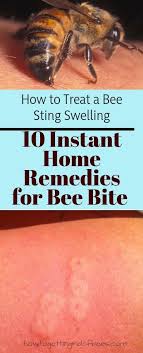 Black And White Wasp Sting Treatment Pin On Health Exercise