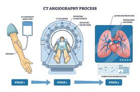 Image result for CT Intravenous Contrast