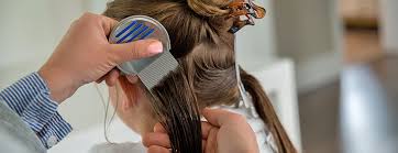 Check the scalp for lice. Why You Need A Lice Comb Lice Clinics Of America Columbus Oh