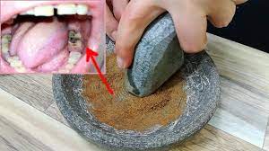 Pin On Tooth Pain Relief When My Teeth Hurt Toothache Immediate Pain Relief