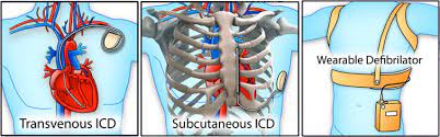 Instead of attaching directly to your sternum, they all attach to your lowest true rib. What Organ Is Behind Your Right Lower Rib And Cup Hood Chapter 1 Catalogue Of Tombs In The Phoebe A Hearst Expedition To Naga Ed Deir Cemeteries N 2000 And N