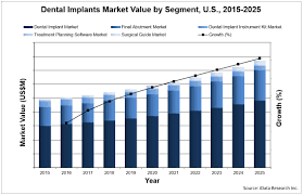 Dental Implants Market Analysis Size Trends Global
