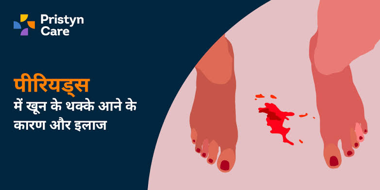 पीरियड में खून के थक्के बनने की मुख्य जानकारी, AI generated