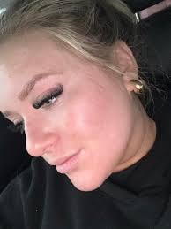 Im a local licensed advanced esthetician & certified acne specialist, I  take clients who are ready to clear their acne through my virtual program.  Perfect for those busy or not wanting to