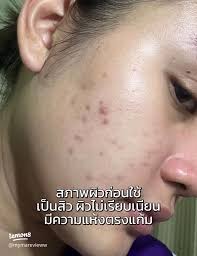 And the skin is smoother, right?