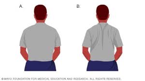 We did not find results for: Slide Show Back Exercises In 15 Minutes A Day Mayo Clinic