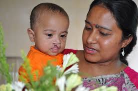 Rotaplast Missions: 2011 Chittagong, Bangladesh