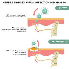 Image result for Herpes Simplex Virus Testing