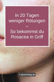 Home » gesundheit » krankheiten » rote äderchen im gesicht: 32 Rosacea Ideen In 2021 Rosazea Rosacea Behandlung Hautkrankheit Rosacea