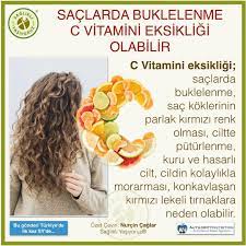 Saclarda Buklelenme C Vitamini Eksikligi Olabilir C Vitamini Duzenli Olarak Vucuda Alinmasi Gereken Onemli Mikro Besinlerdendir Hair Styles Hair Beauty